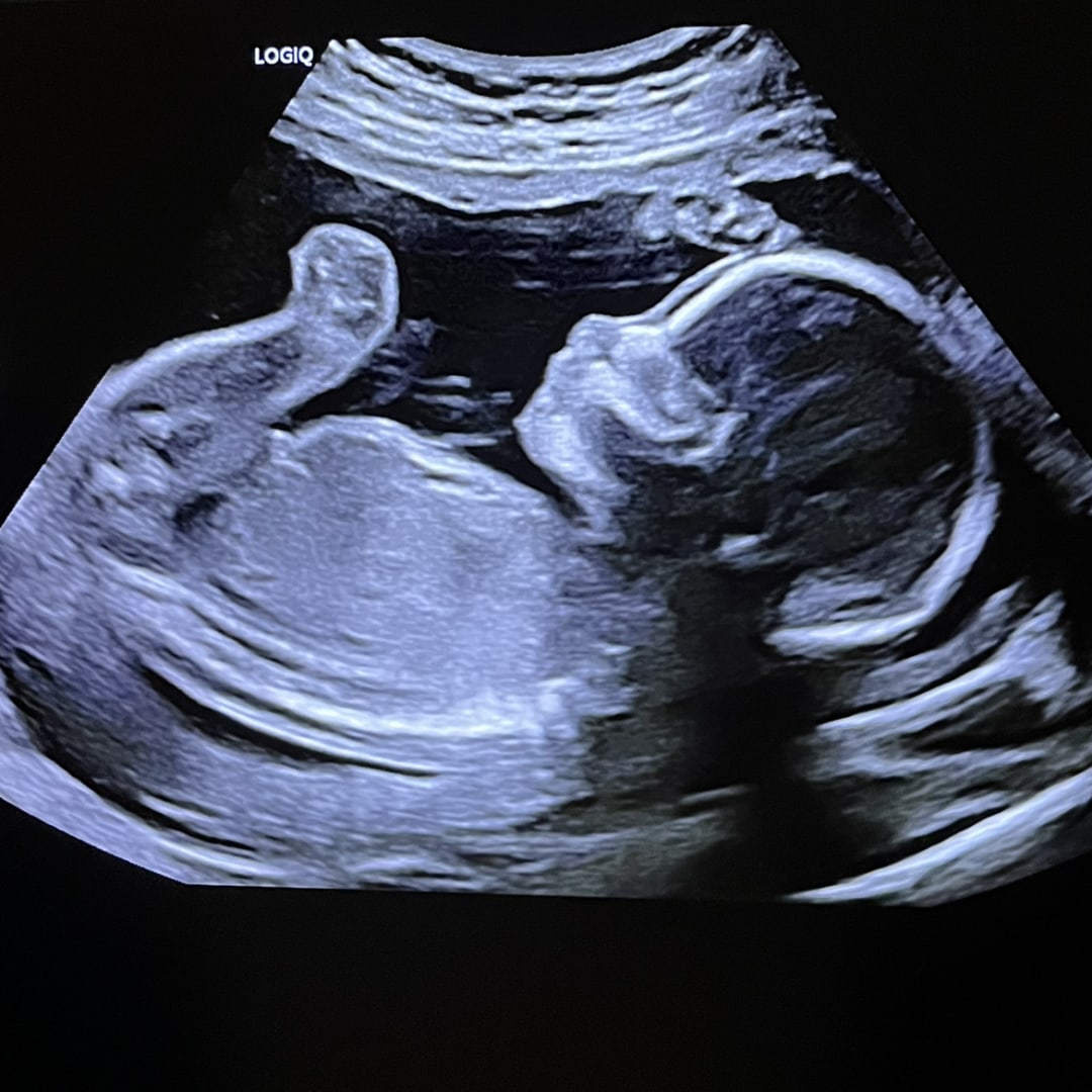 Photo shared by Allison for their Babylist baby registry.
