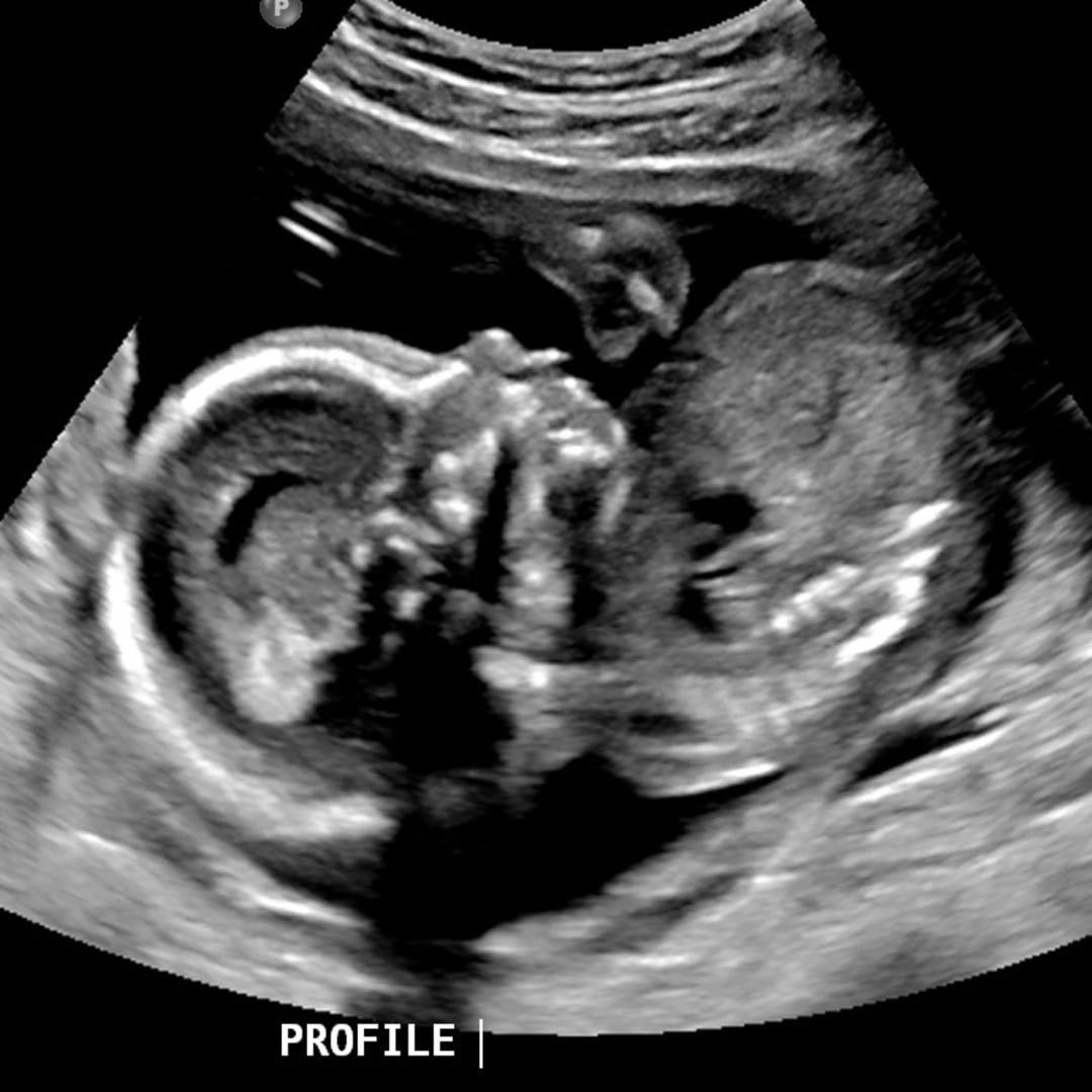 Photo shared by Gabi for their Babylist baby registry.