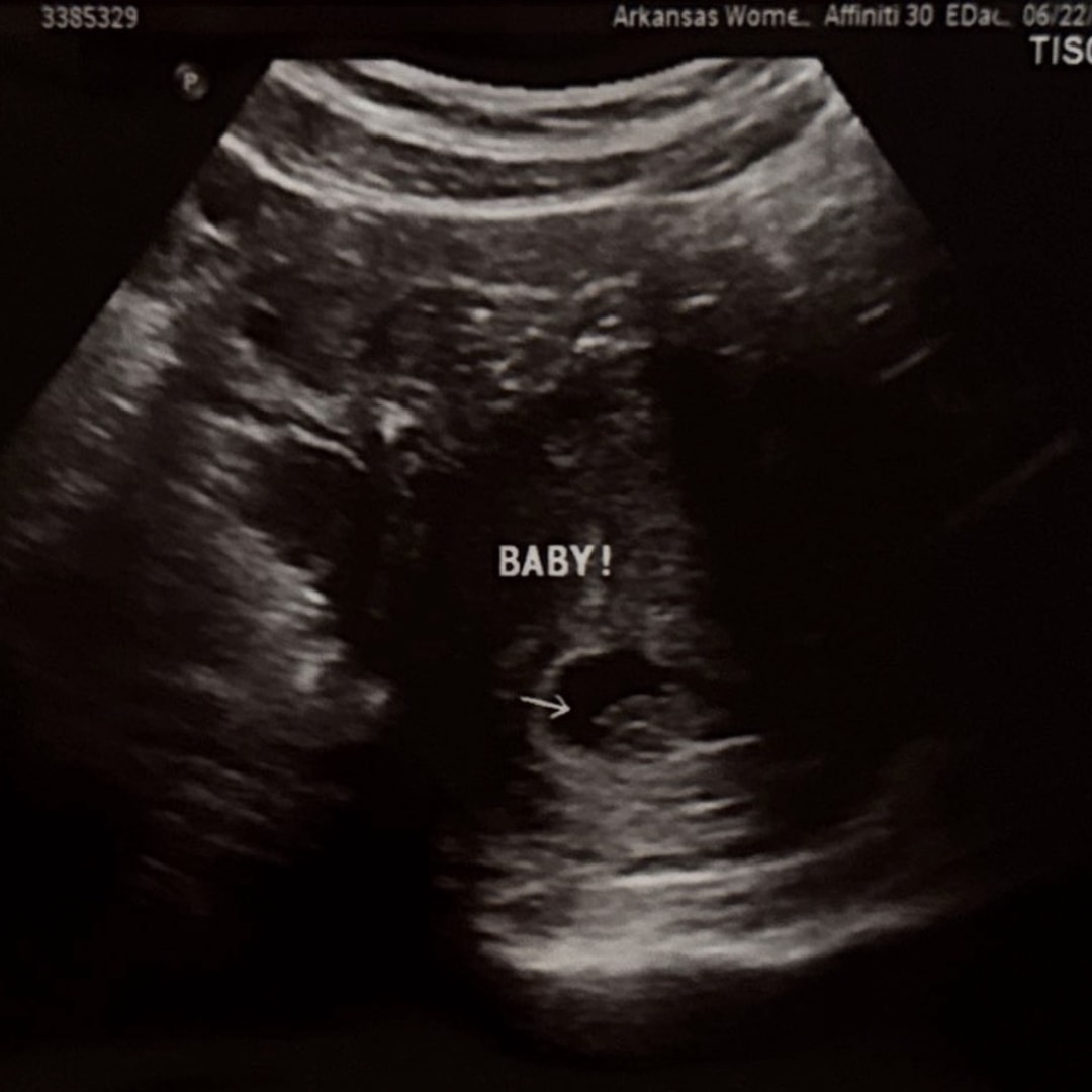 Photo shared by Brynn for their Babylist baby registry.