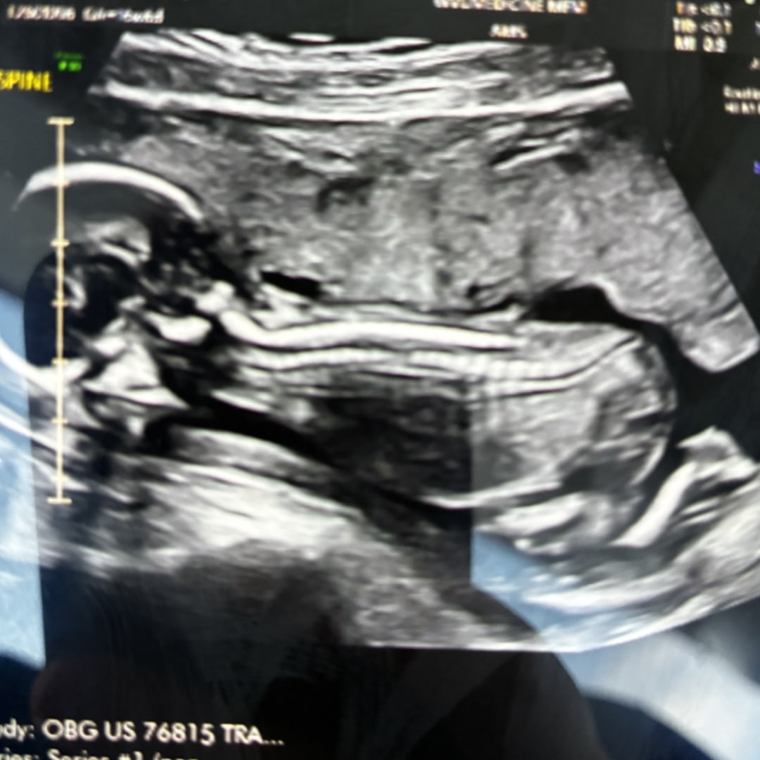 Photo shared by Destiny for their Babylist baby registry.