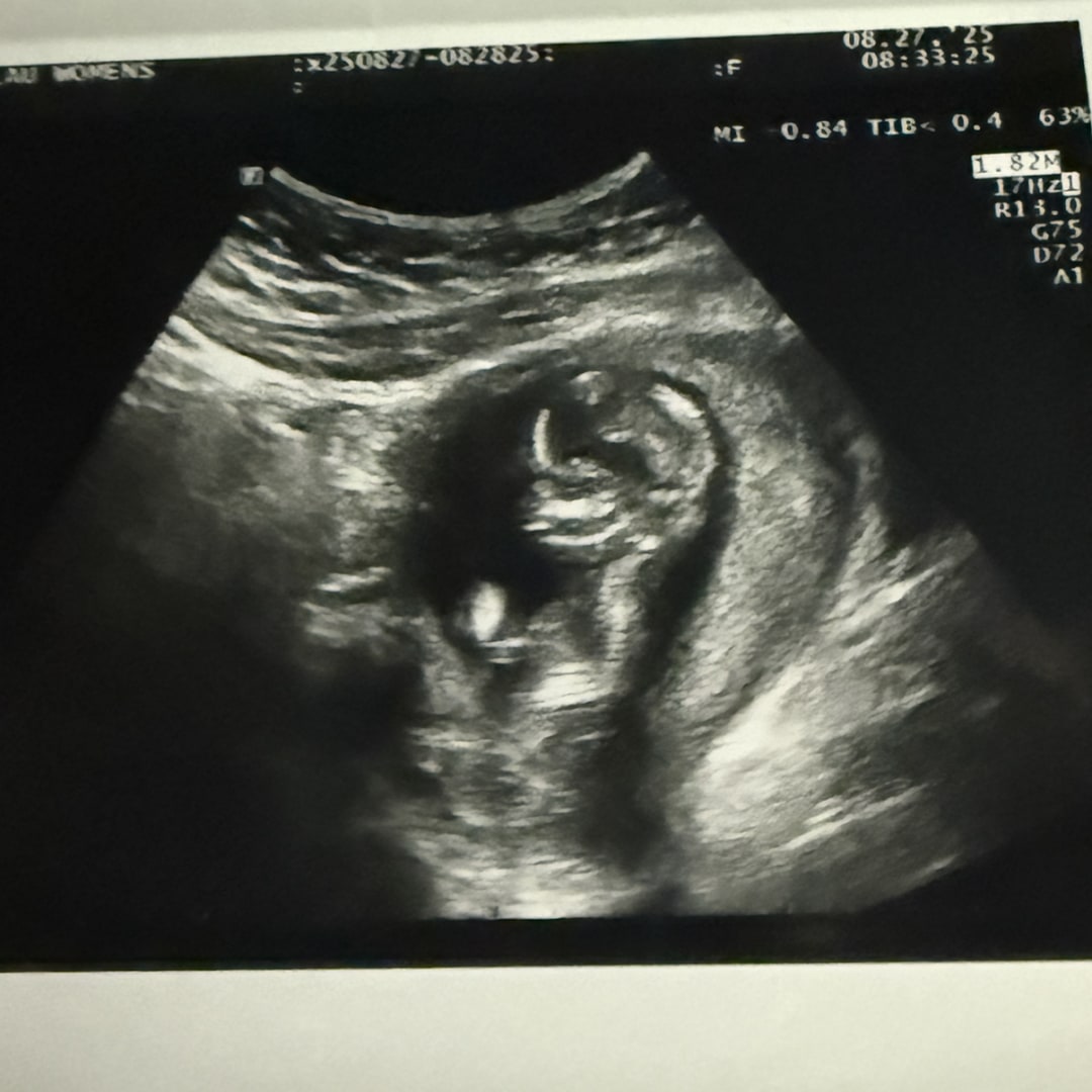 Photo shared by Hannah for their Babylist baby registry.