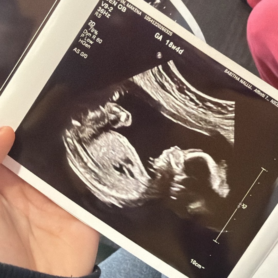 Photo shared by Makena for their Babylist baby registry.