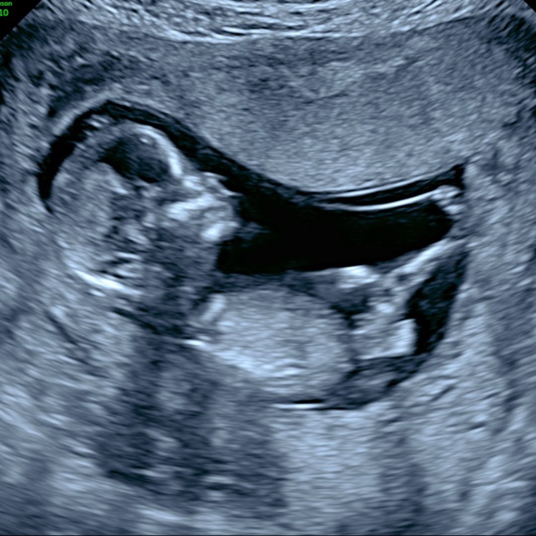 Photo shared by Alicia for their Babylist baby registry.
