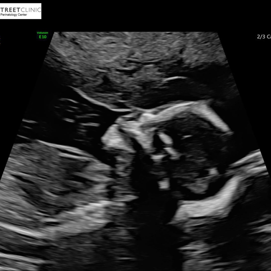 Photo shared by Gabby for their Babylist baby registry.