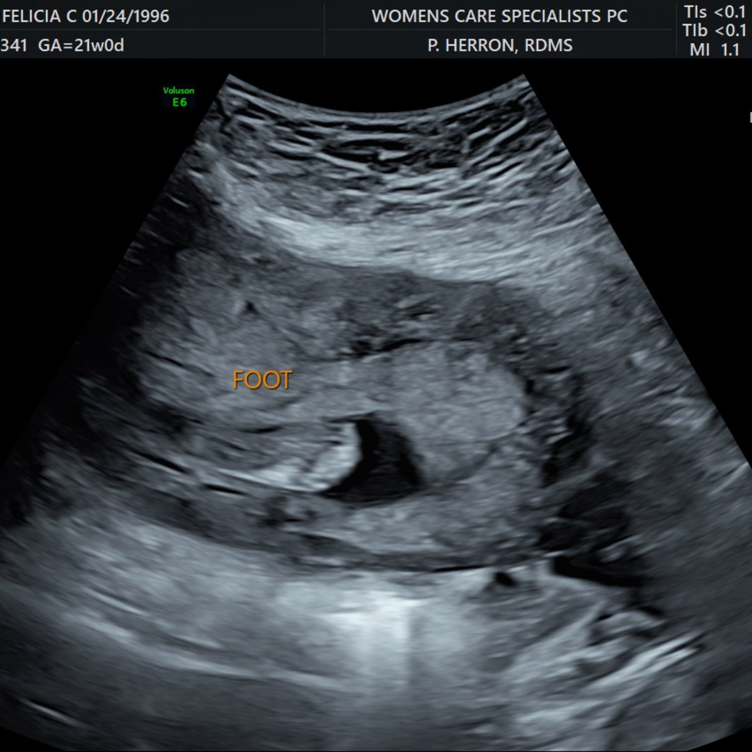 Photo shared by Felicia for their Babylist baby registry.