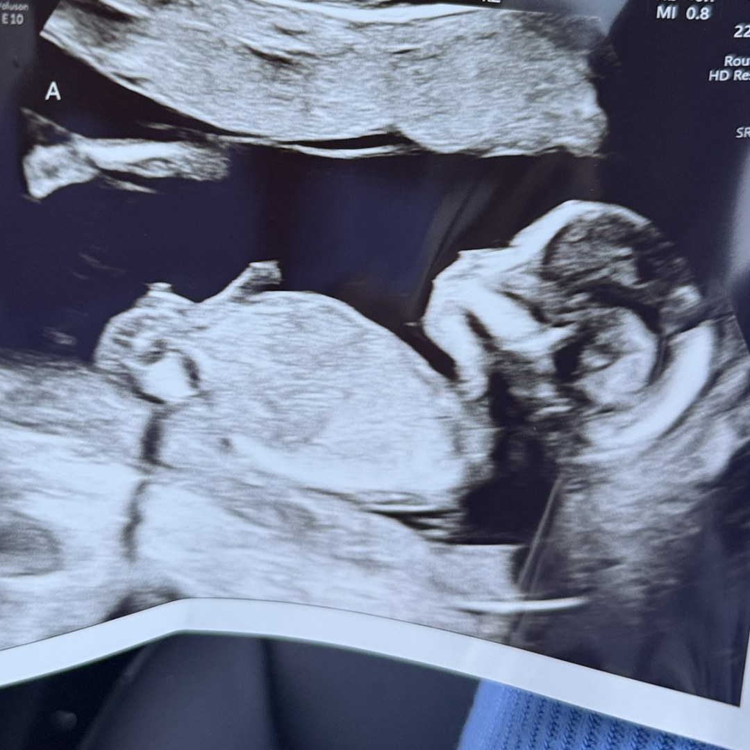 Photo shared by Dominique for their Babylist baby registry.