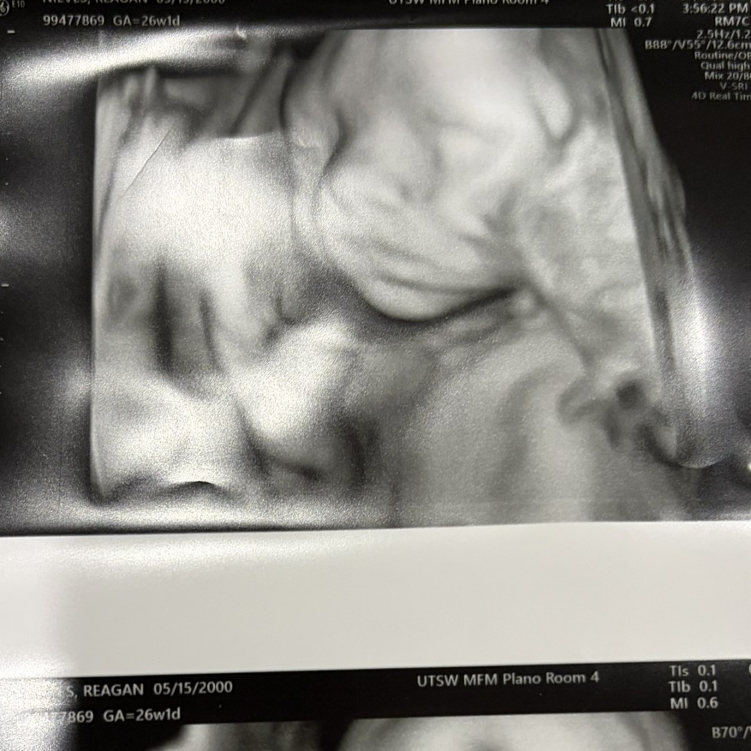 Photo shared by Reagan for their Babylist baby registry.