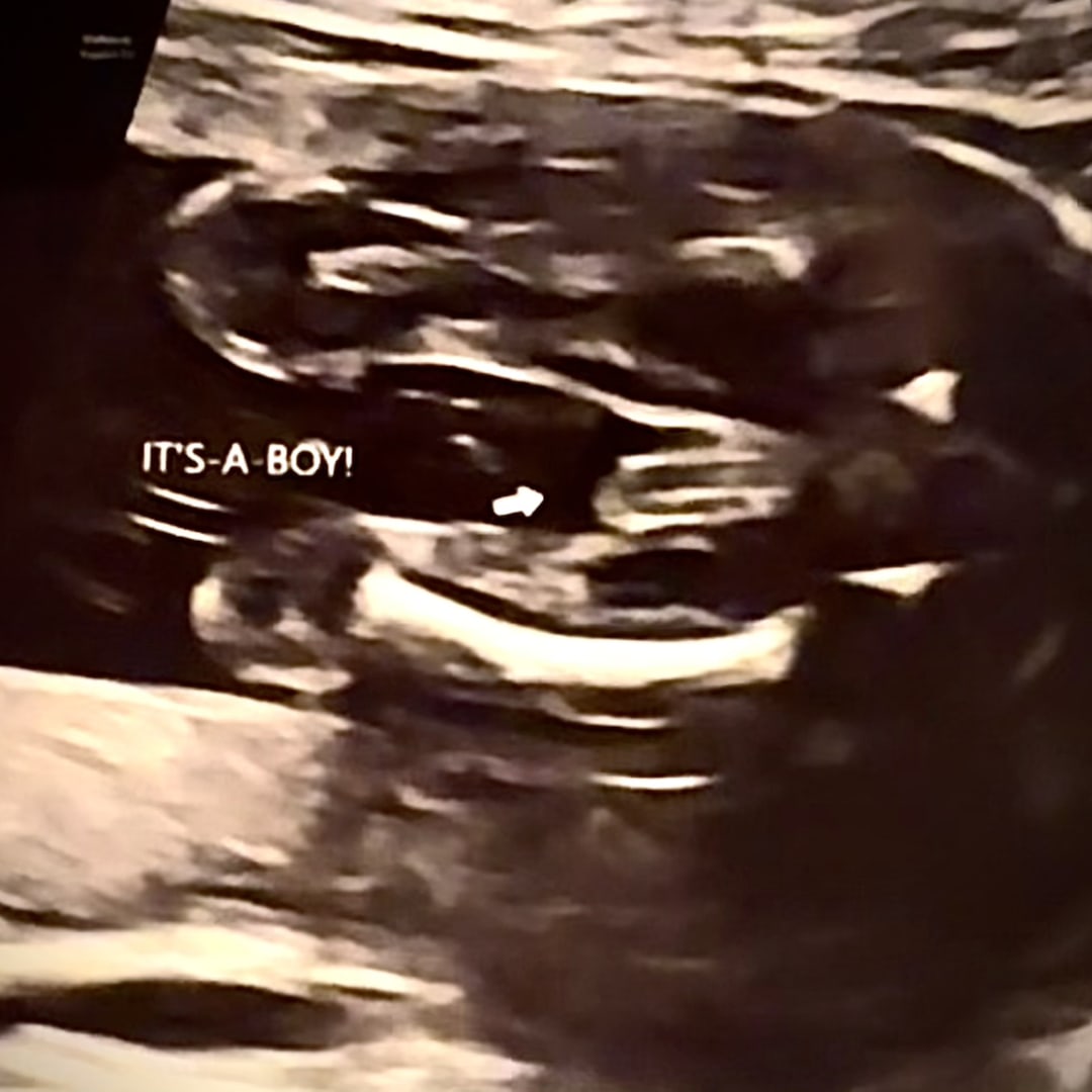 Photo shared by Leah for their Babylist baby registry.