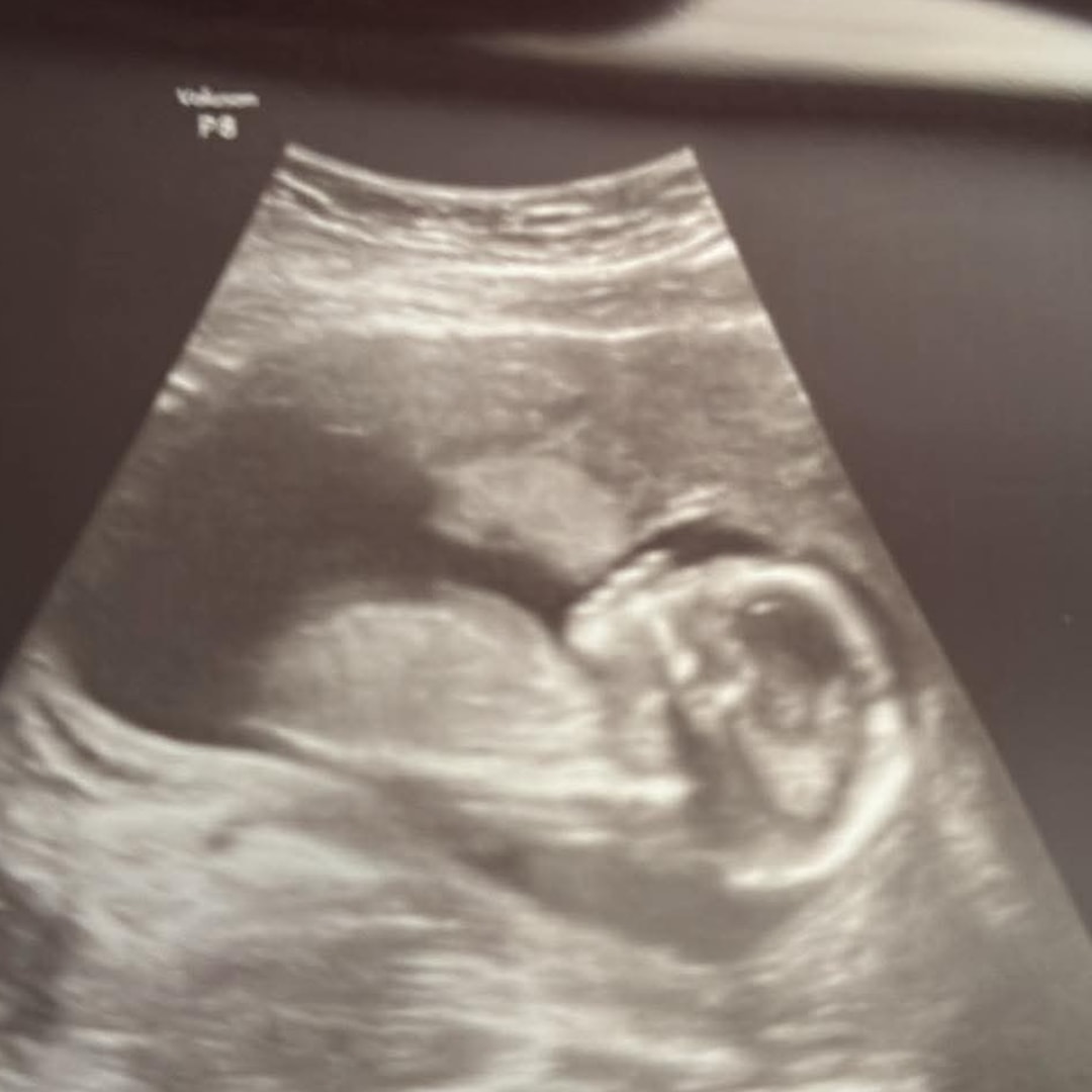 Photo shared by Constance for their Babylist baby registry.