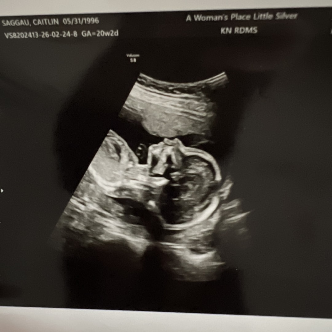 Photo shared by Caitlin for their Babylist baby registry.