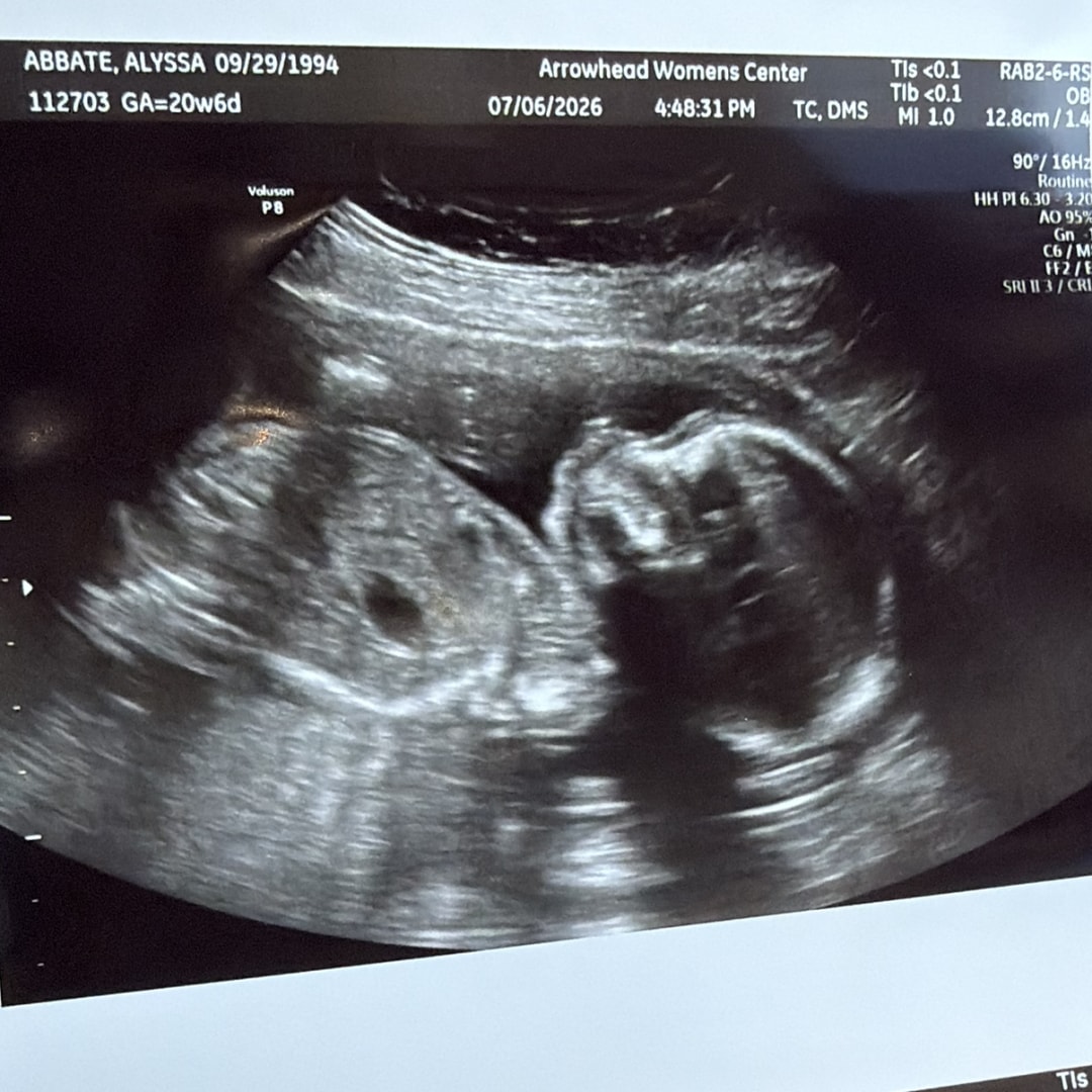 Photo shared by Alyssa for their Babylist baby registry.
