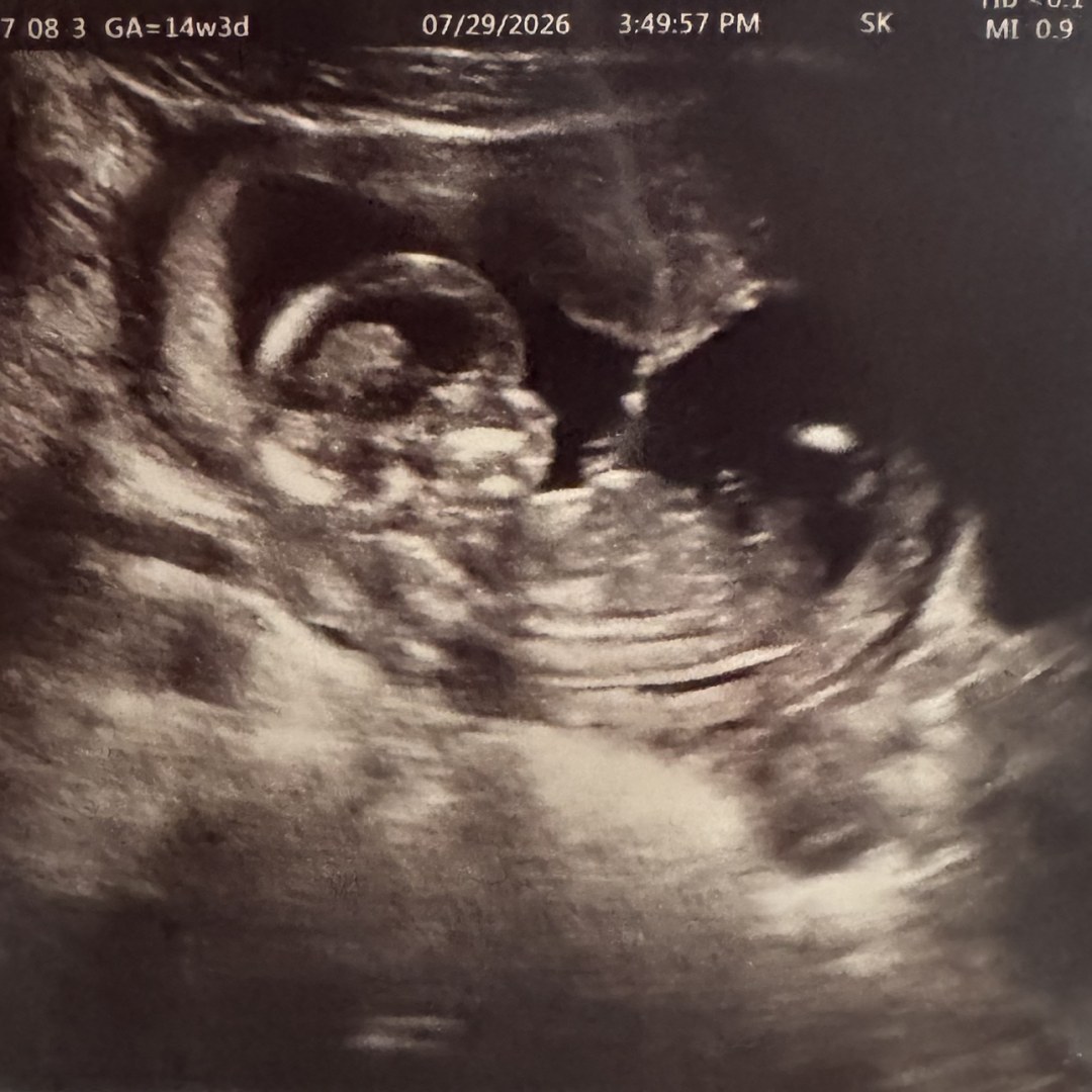 Photo shared by Sadie for their Babylist baby registry.