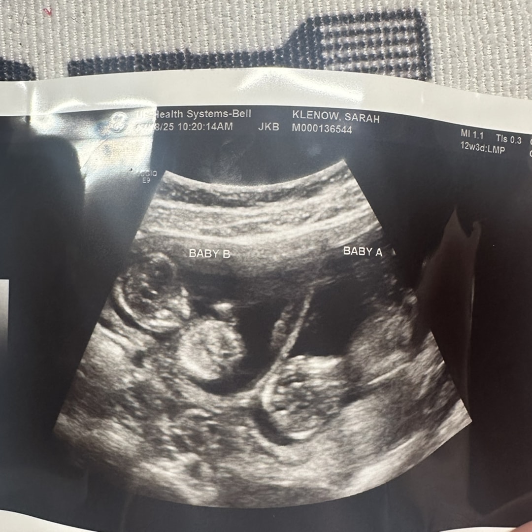 Photo shared by Sarah for their Babylist baby registry.