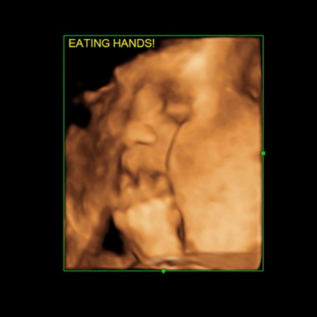 Photo shared by Emma for their Babylist baby registry.