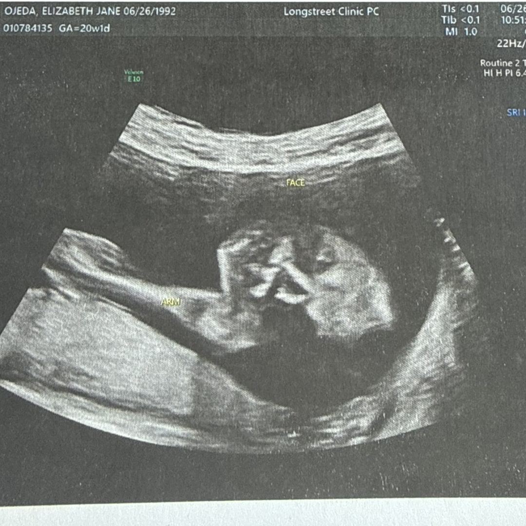 Photo shared by Elizabeth for their Babylist baby registry.