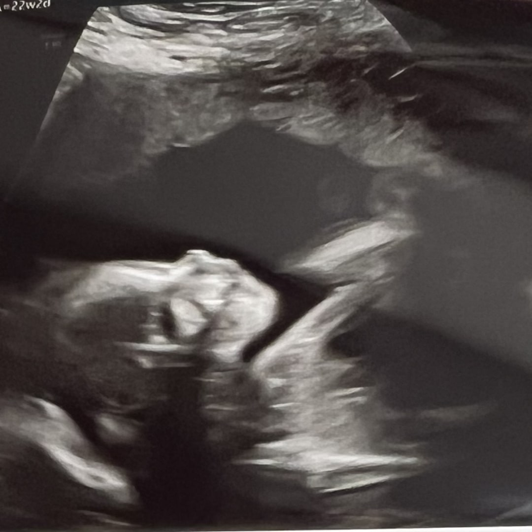 Photo shared by Isabella for their Babylist baby registry.