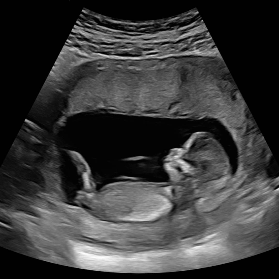 Photo shared by Keli for their Babylist baby registry.