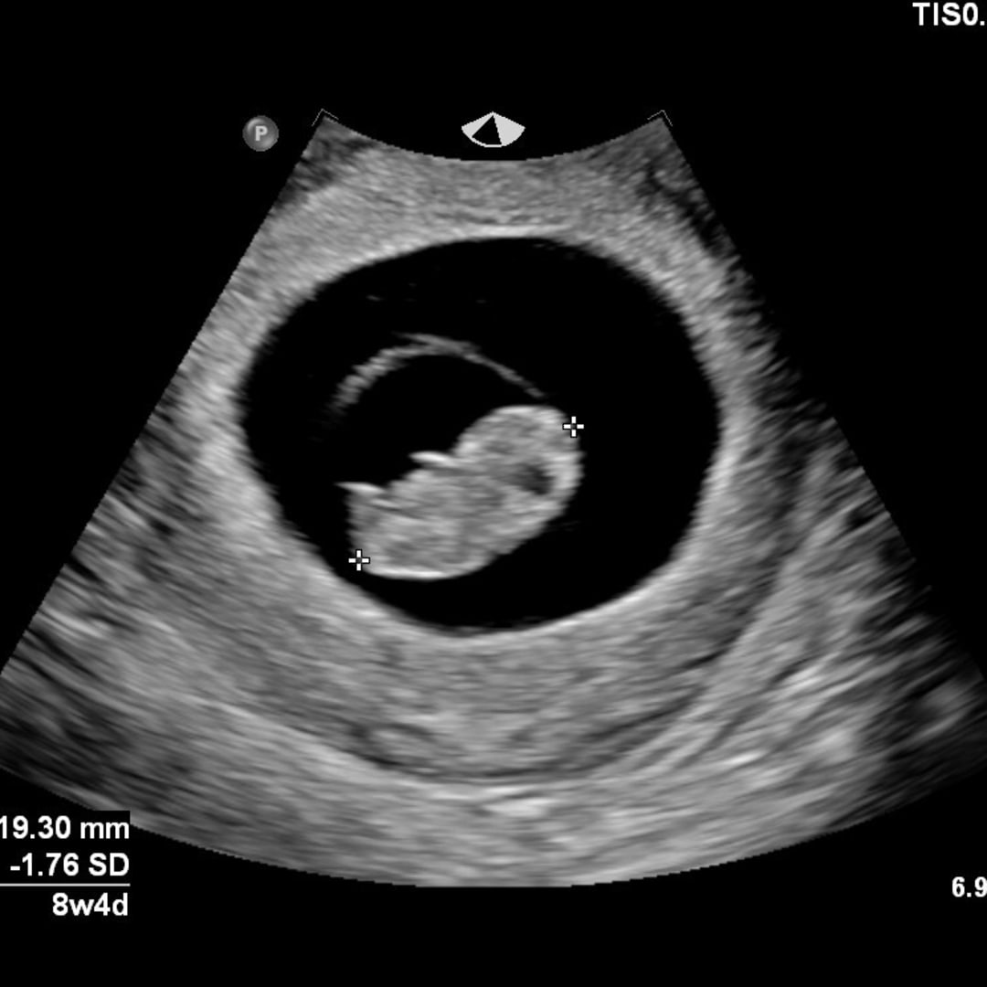 Photo shared by Alexis for their Babylist baby registry.