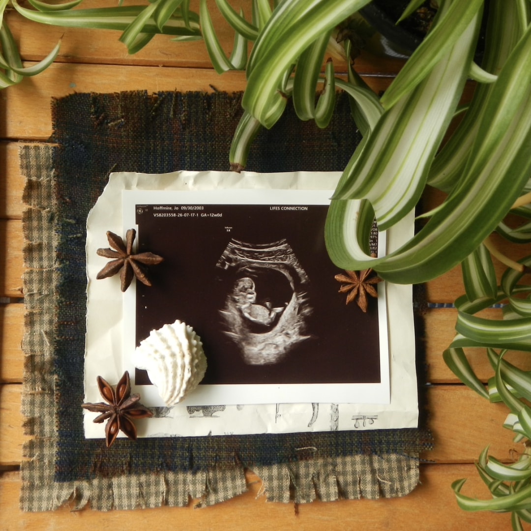 Photo shared by Jo for their Babylist baby registry.