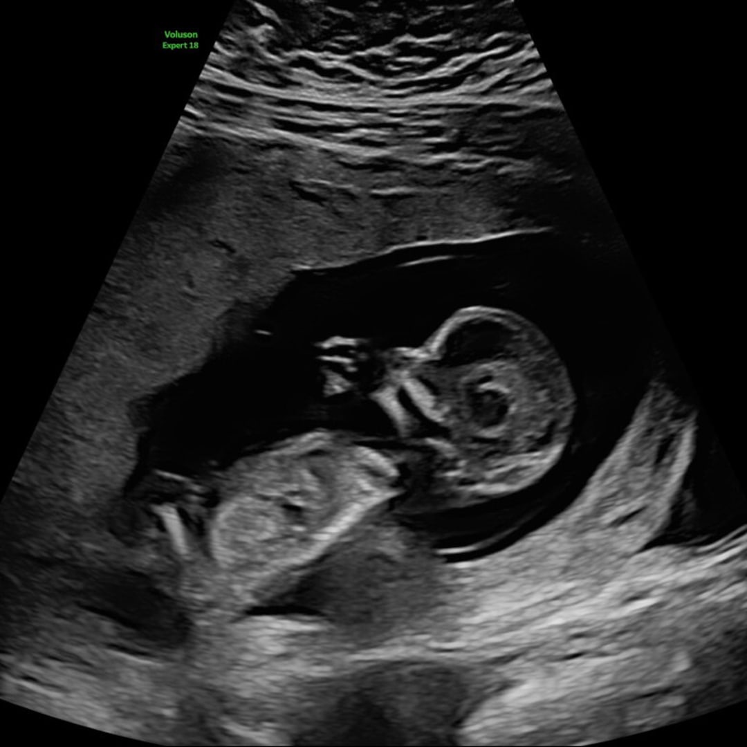 Photo shared by Annalease for their Babylist baby registry.