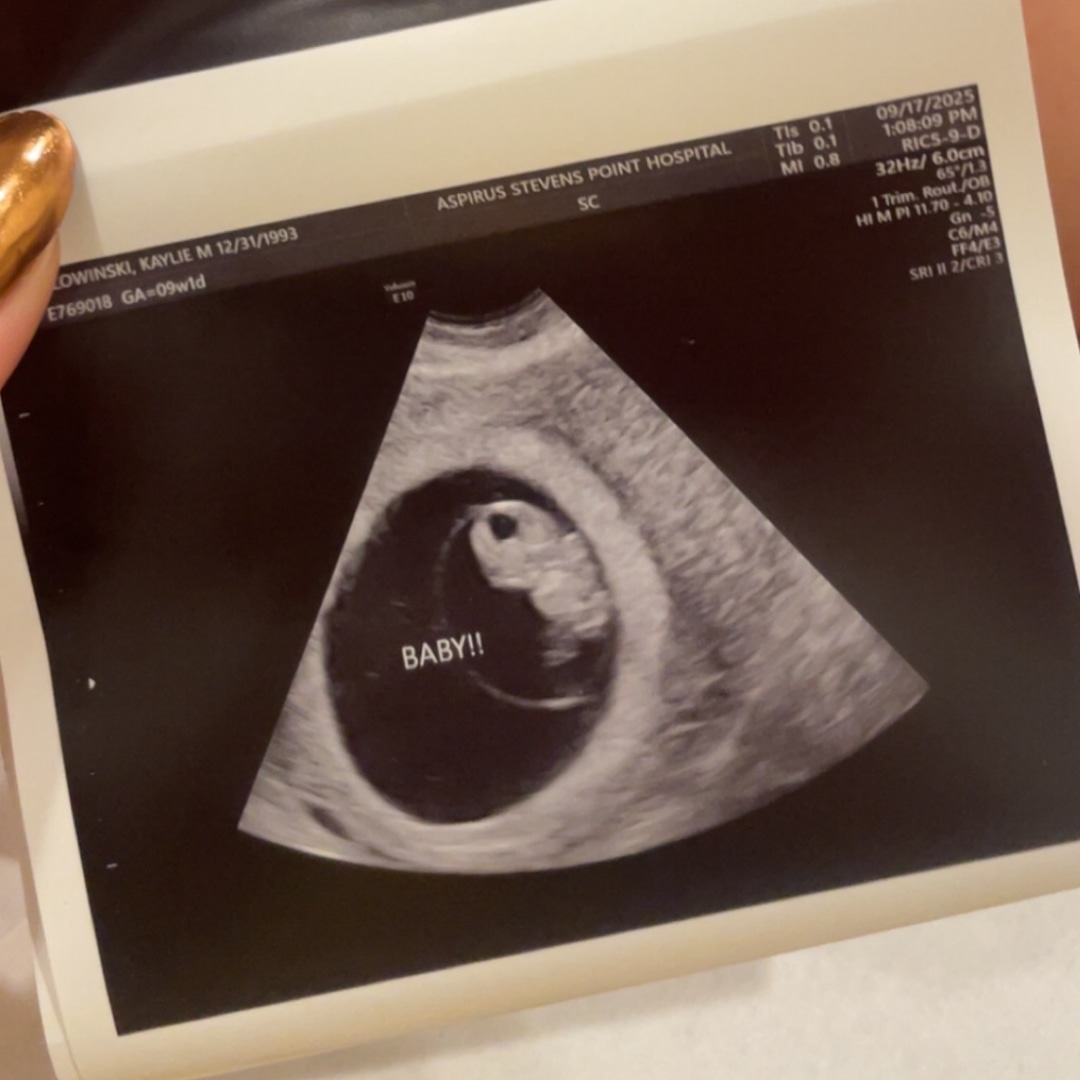 Photo shared by Kaylie for their Babylist baby registry.