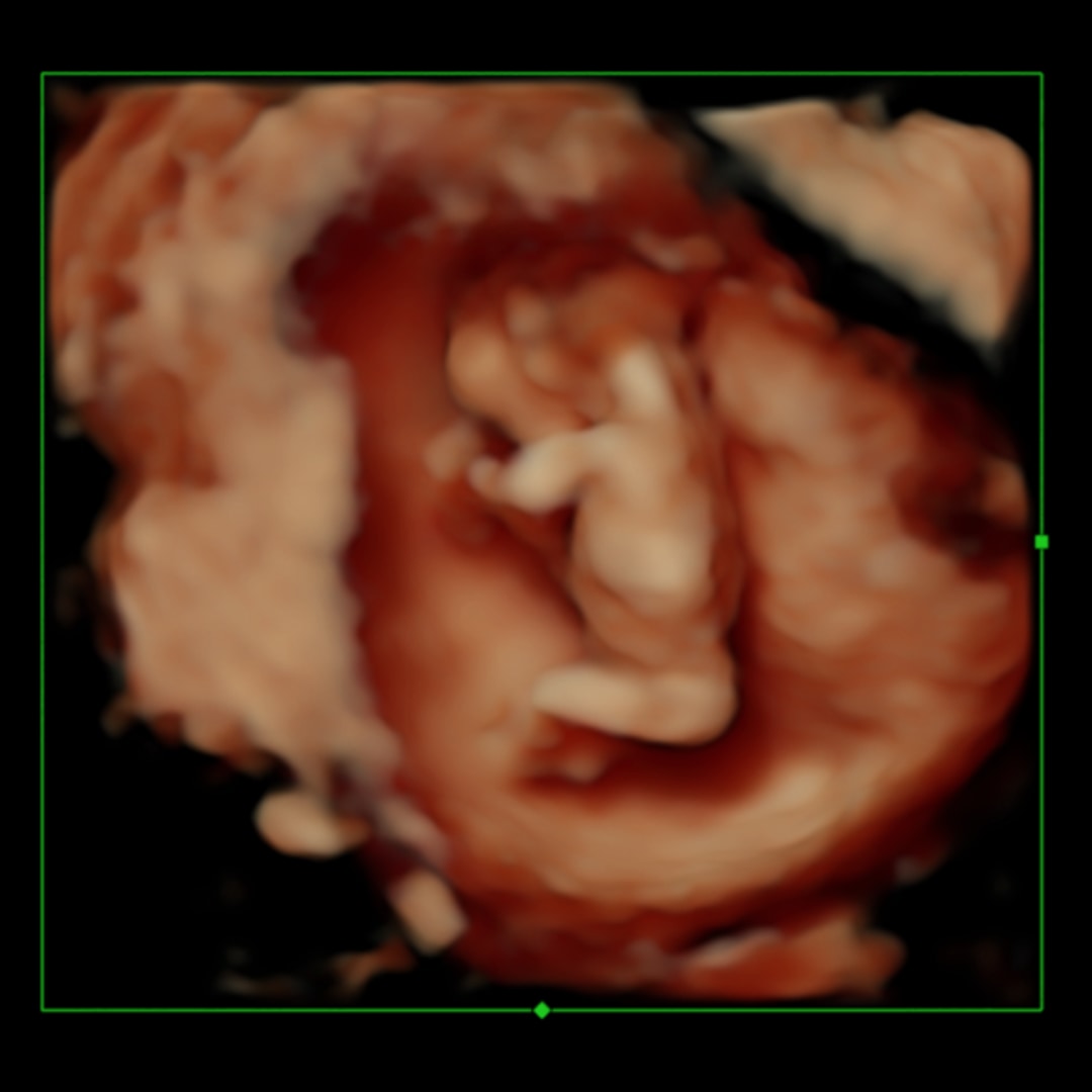 Photo shared by Brilynn for their Babylist baby registry.