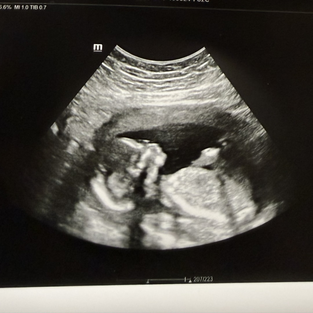 Photo shared by Jade for their Babylist baby registry.