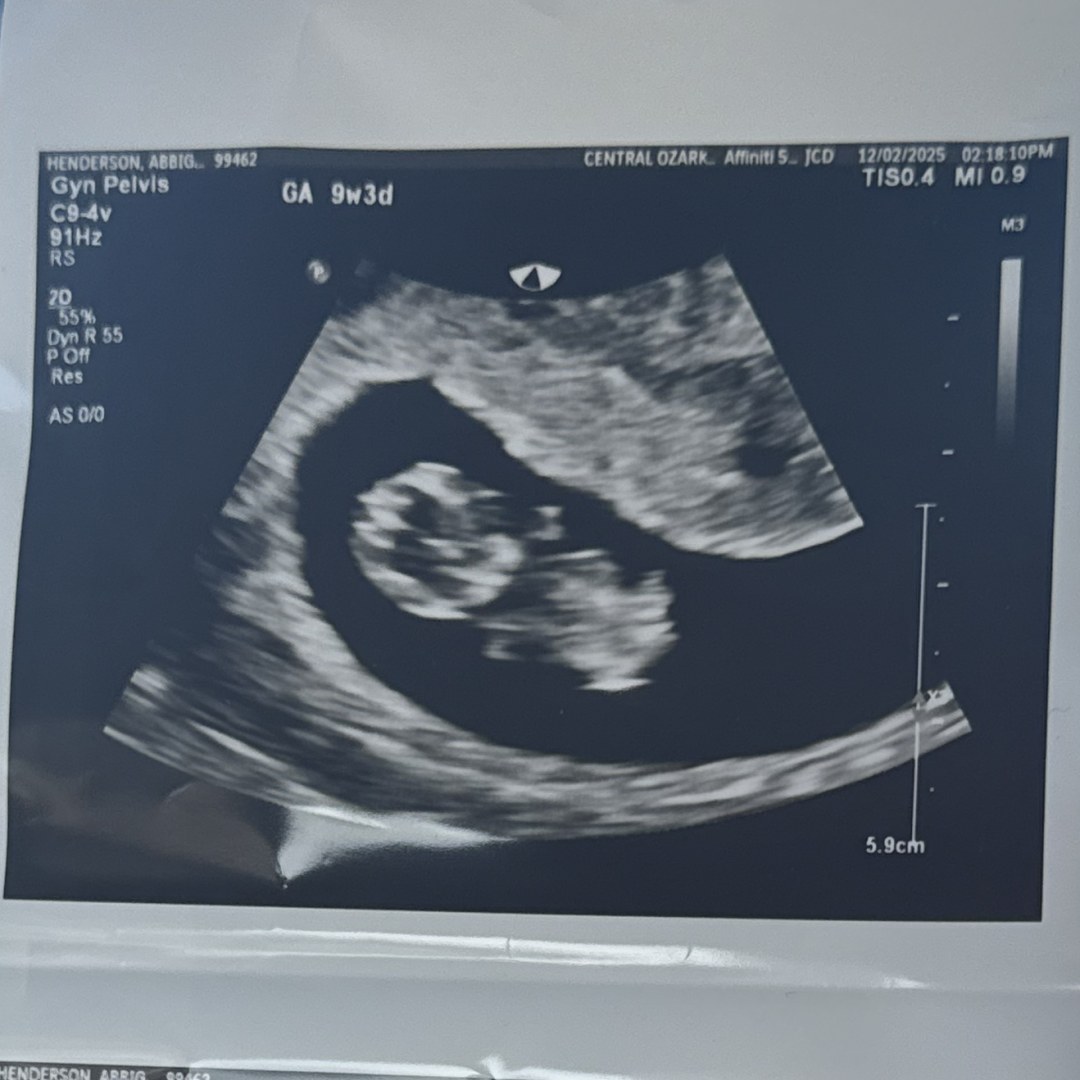 Photo shared by Abbigale for their Babylist baby registry.