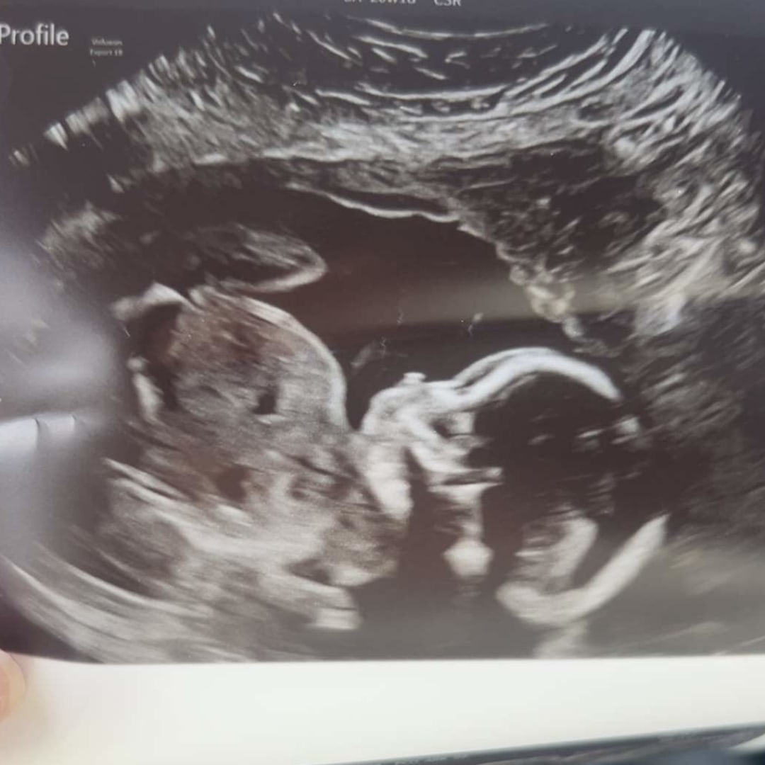 Photo shared by Danielle for their Babylist baby registry.