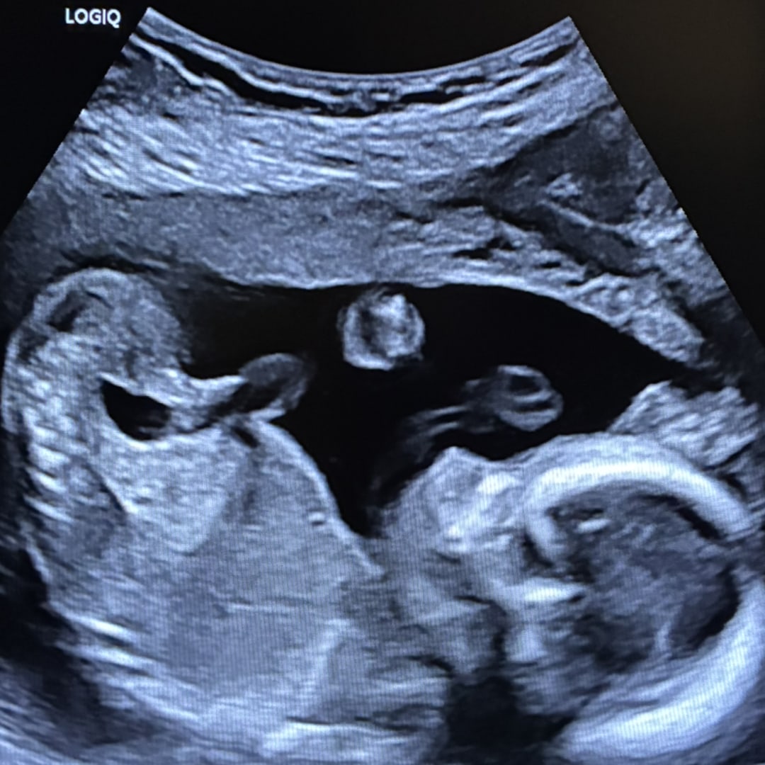 Photo shared by Saphire for their Babylist baby registry.