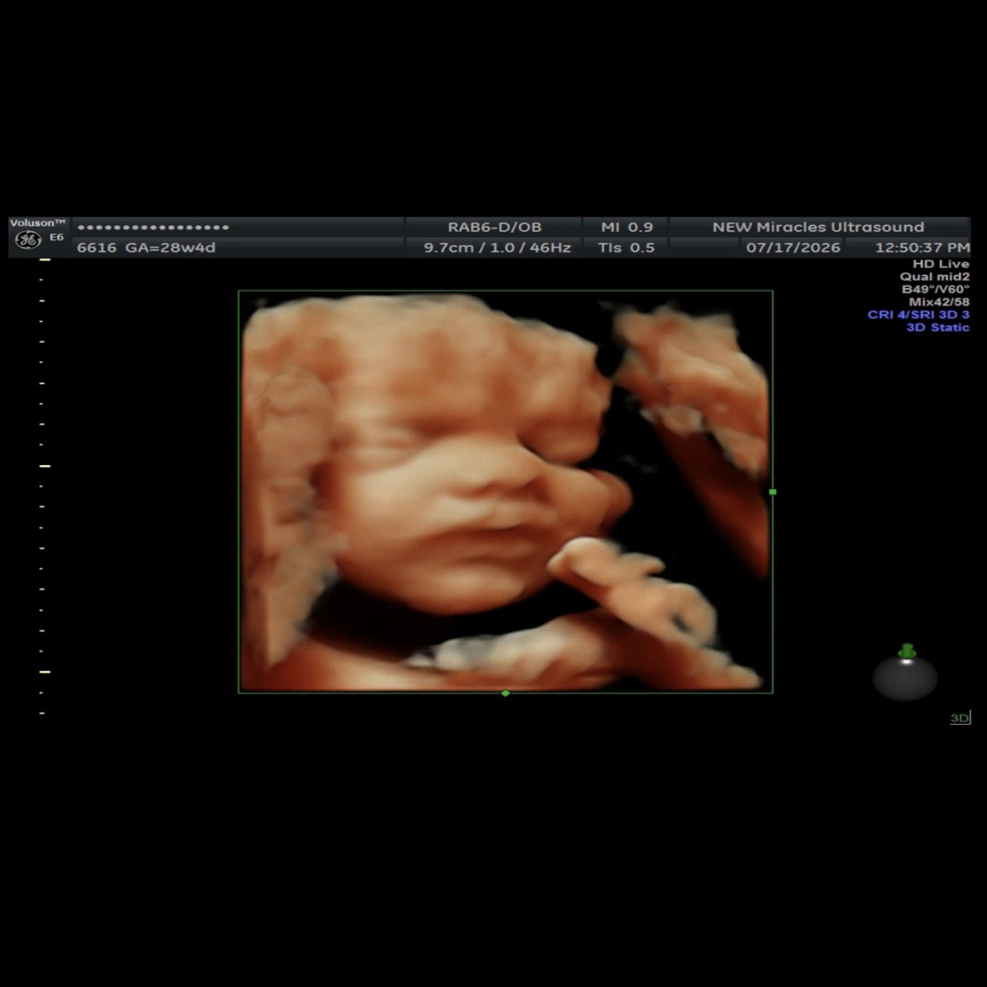 Photo shared by Savannah and Josh for their Babylist baby registry.