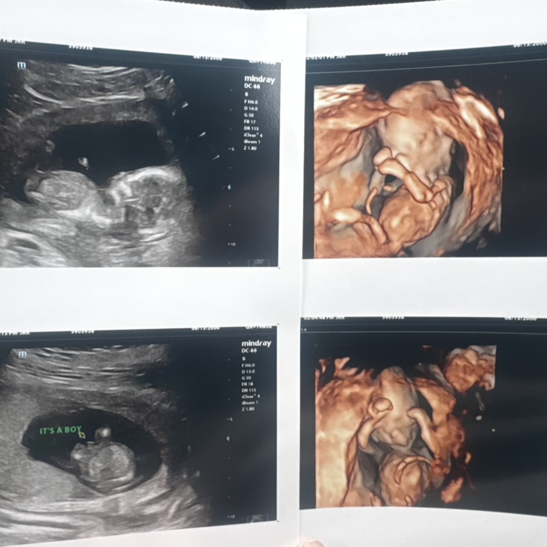 Photo shared by Savanna for their Babylist baby registry.