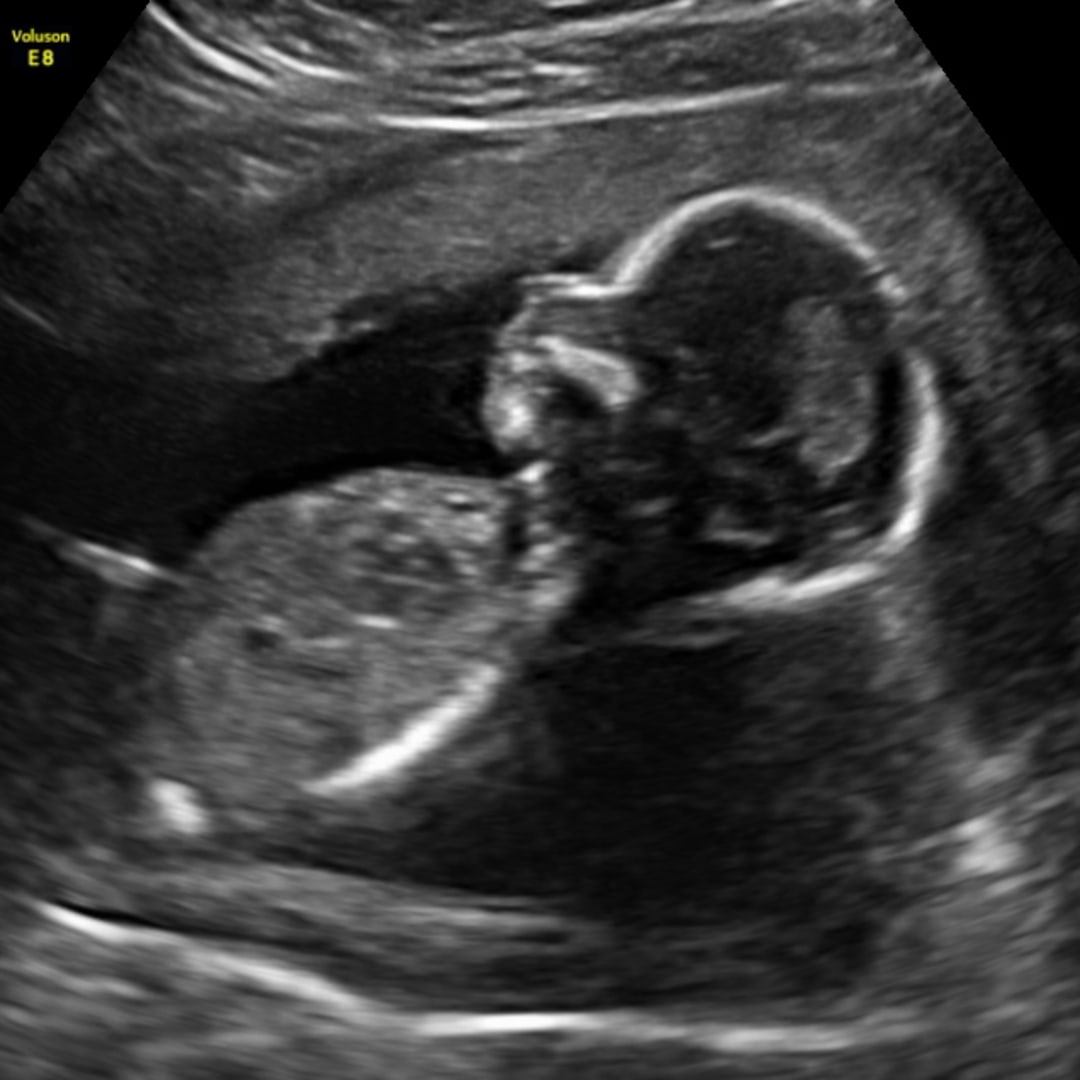 Photo shared by Savannah for their Babylist baby registry.