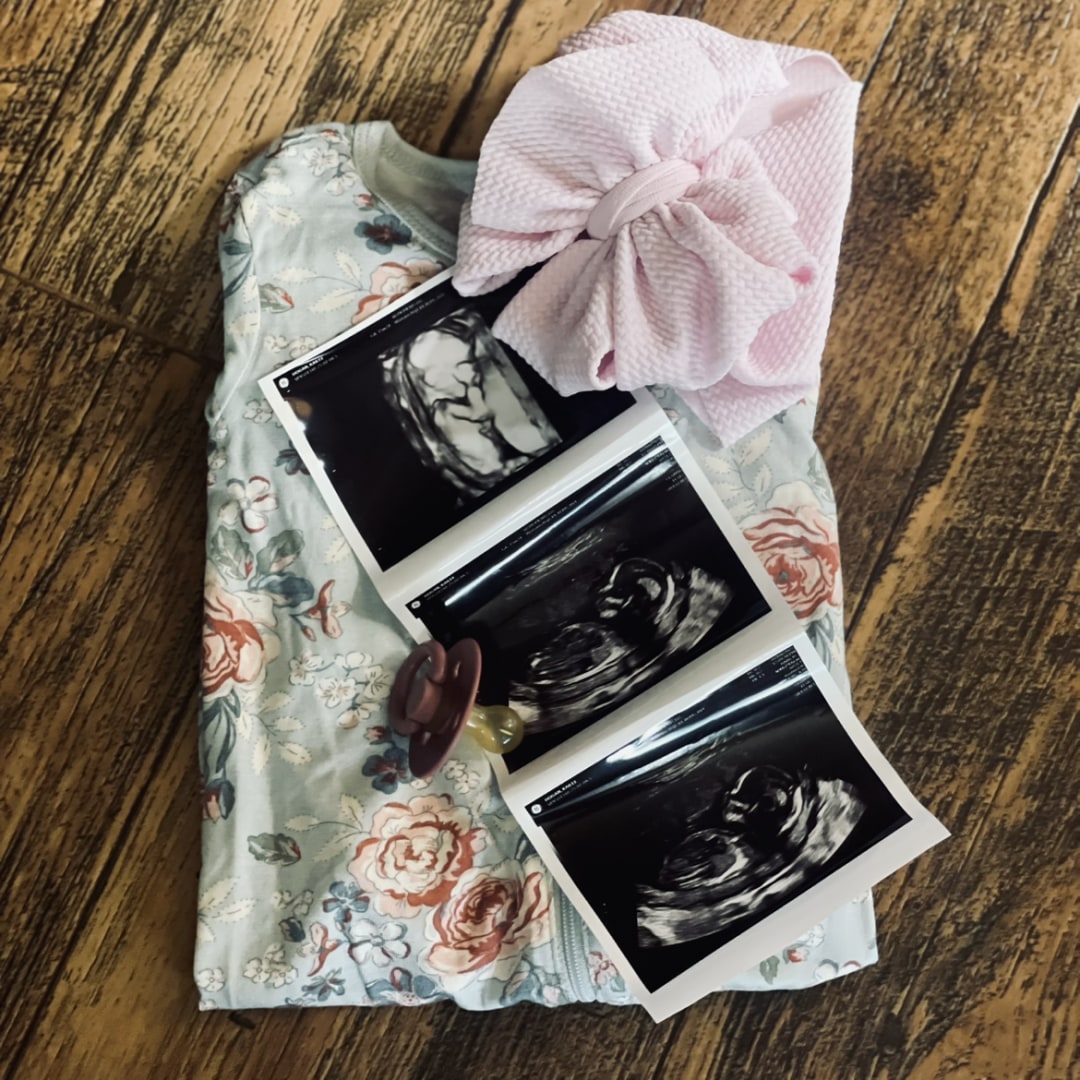 Photo shared by Kailee for their Babylist baby registry.