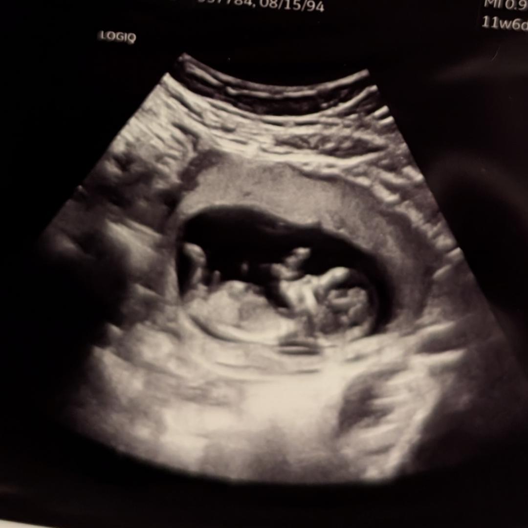 Photo shared by Destiny for their Babylist baby registry.