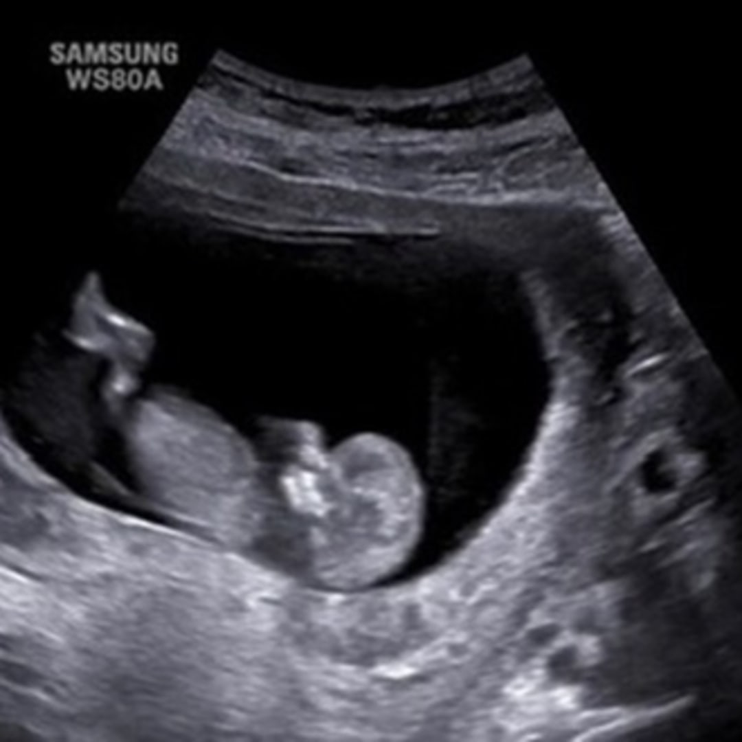 Photo shared by Chloe for their Babylist baby registry.