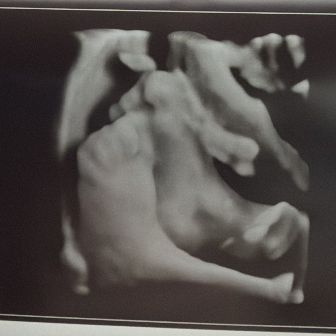 Photo shared by Emma for their Babylist baby registry.