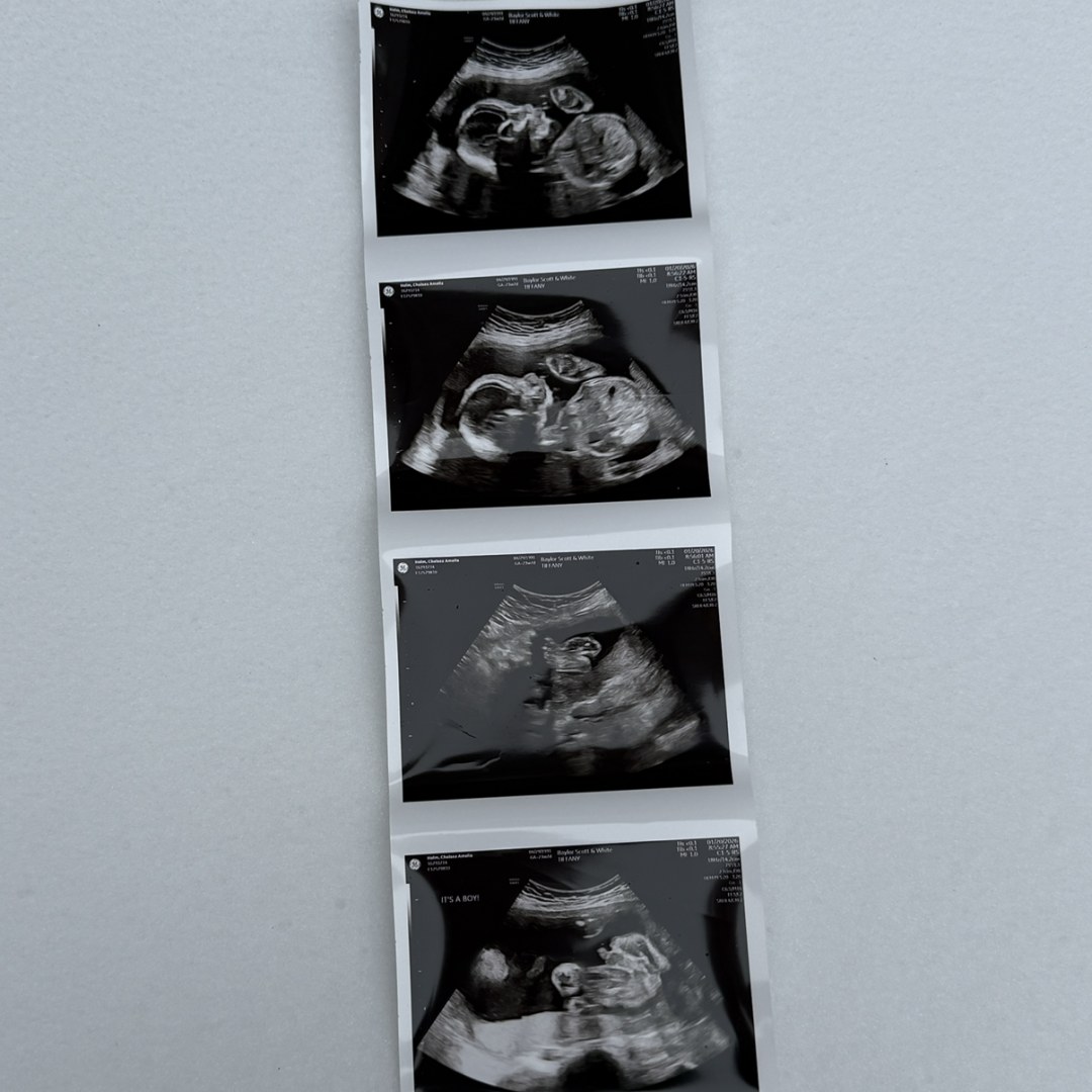 Photo shared by Chelsea for their Babylist baby registry.