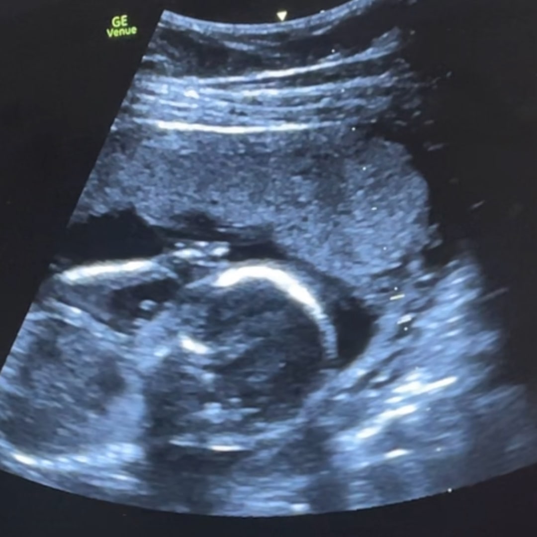 Photo shared by Audrey for their Babylist baby registry.