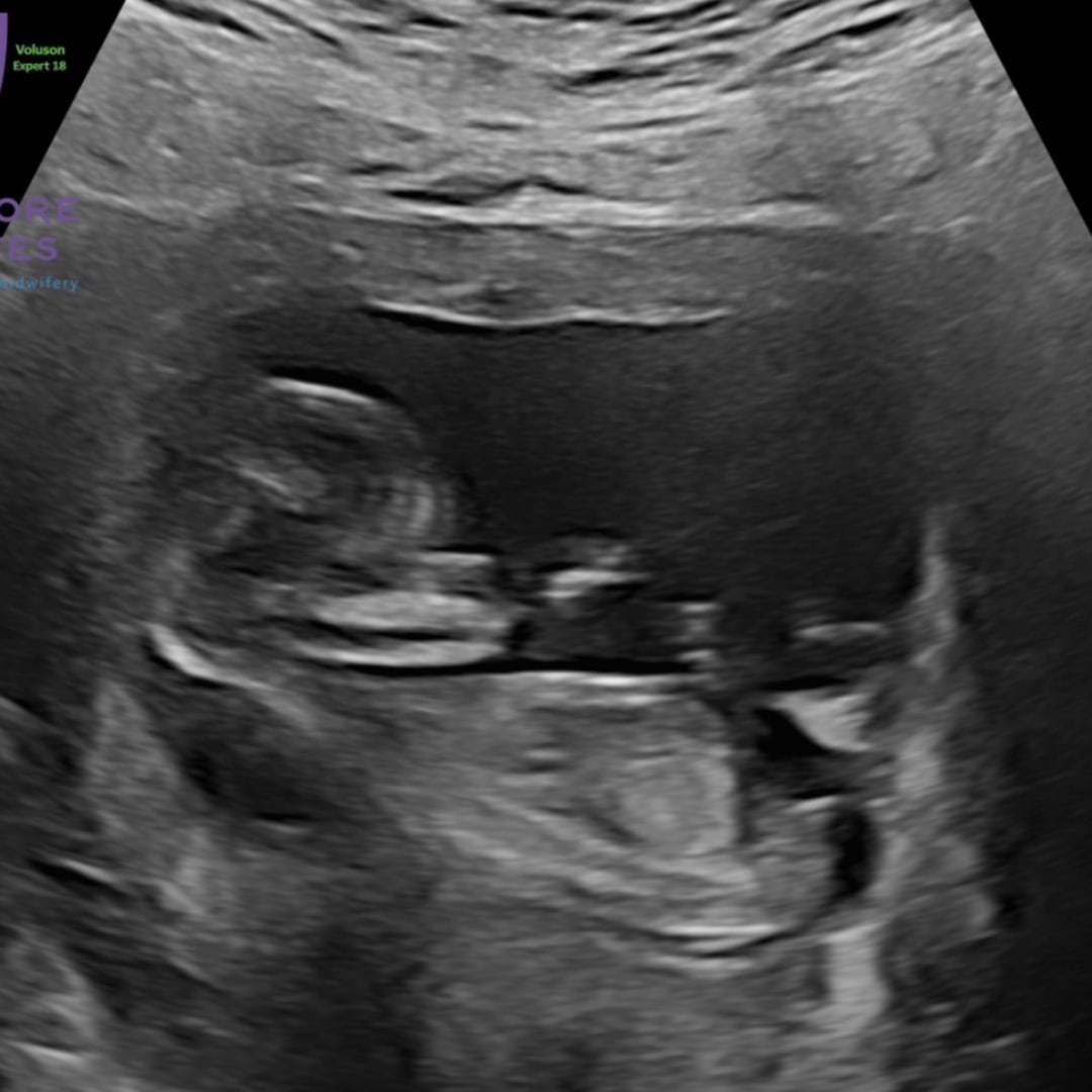 Photo shared by Ryann for their Babylist baby registry.