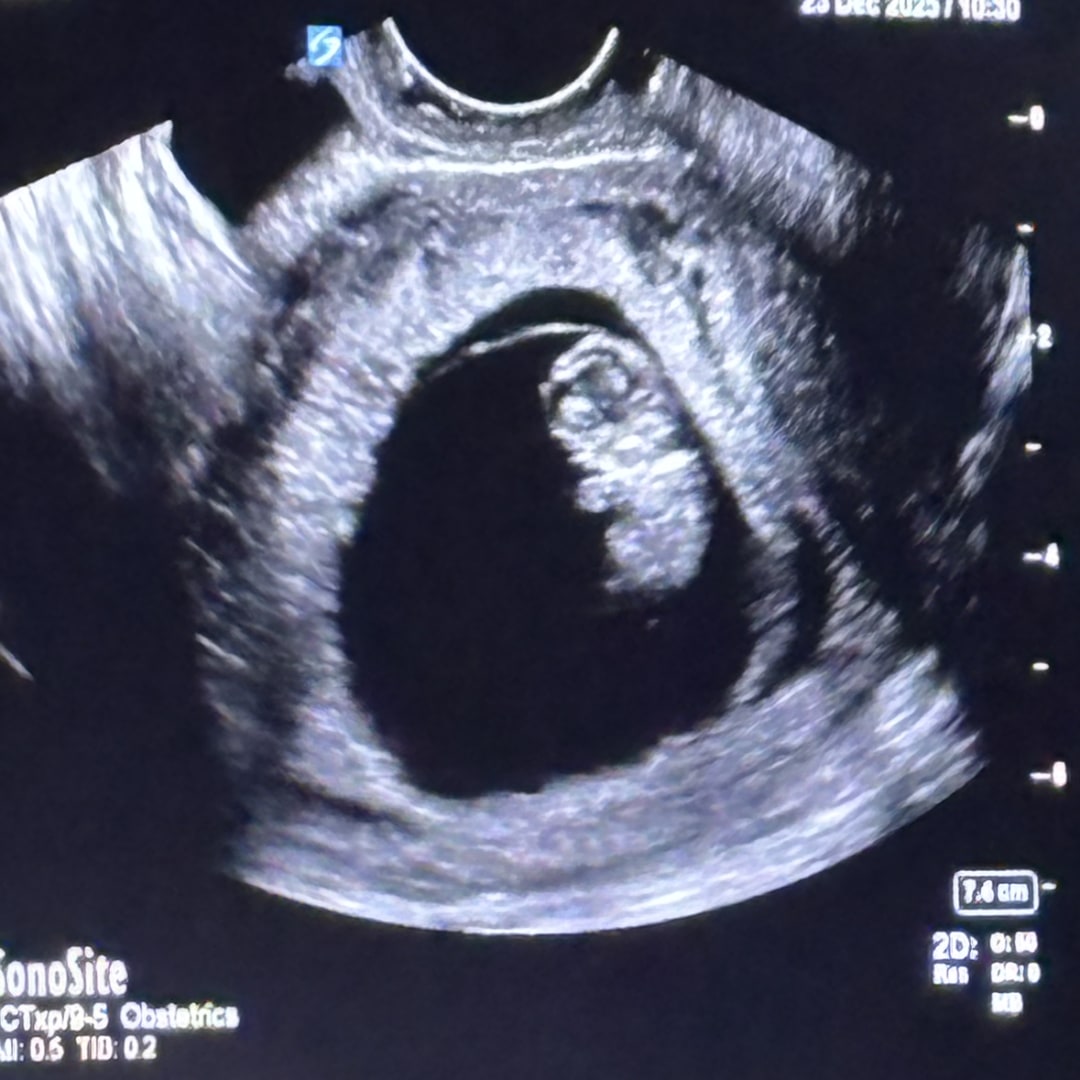 Photo shared by Hailey for their Babylist baby registry.