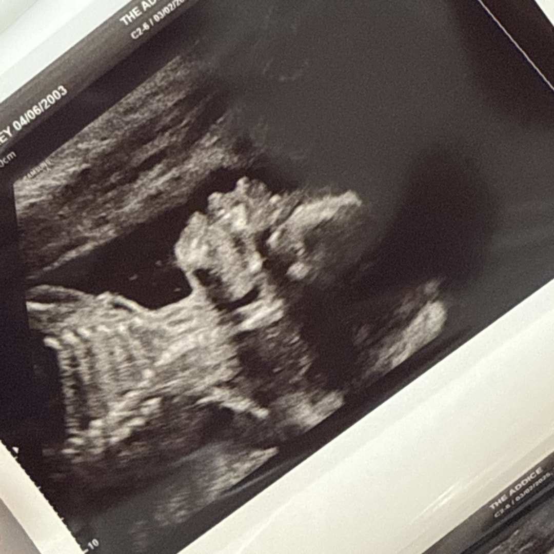 Photo shared by Audrey for their Babylist baby registry.