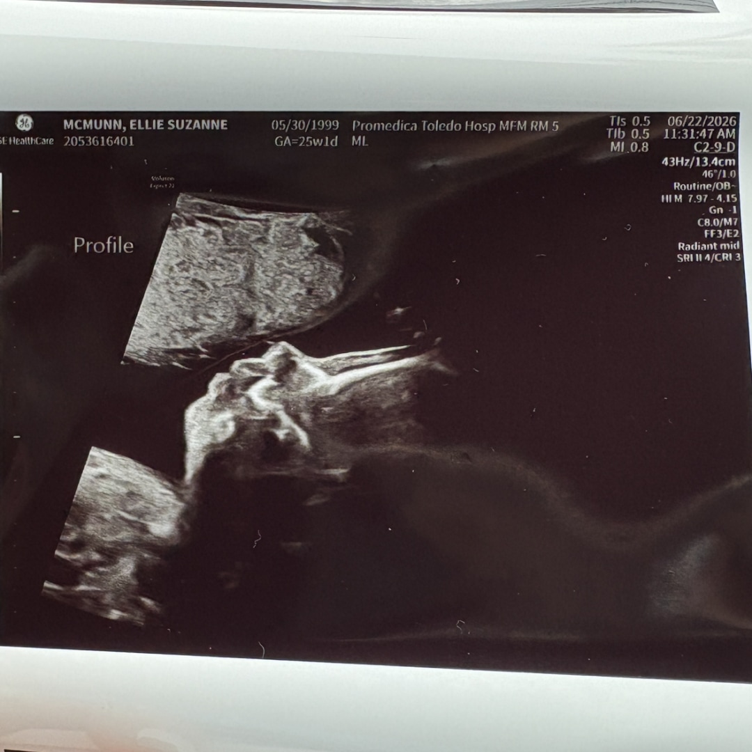 Photo shared by Ellie for their Babylist baby registry.
