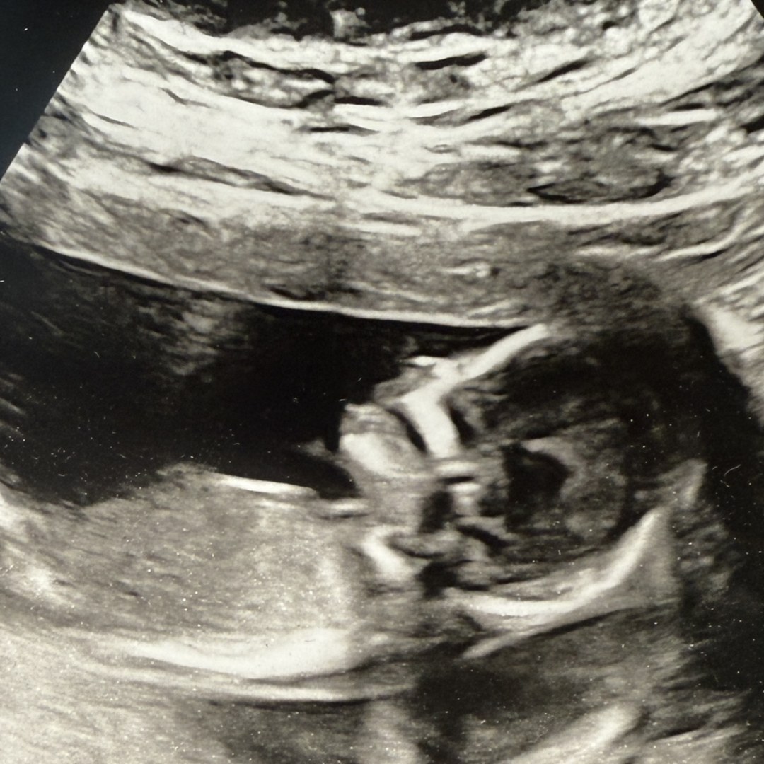Photo shared by Kandyce for their Babylist baby registry.
