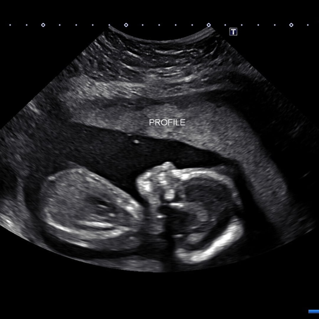 Photo shared by Jesa for their Babylist baby registry.