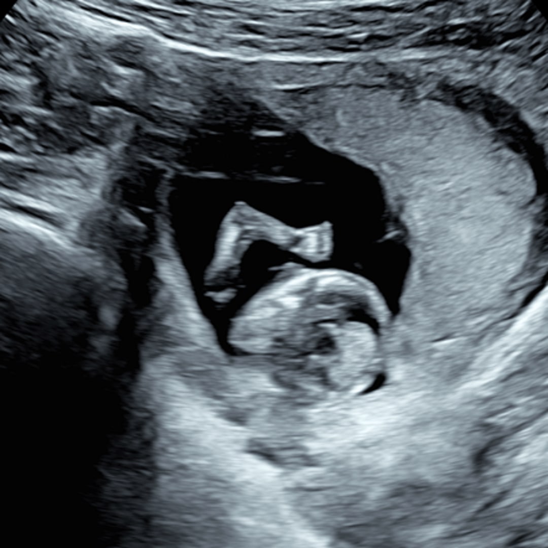 Photo shared by Abigail for their Babylist baby registry.