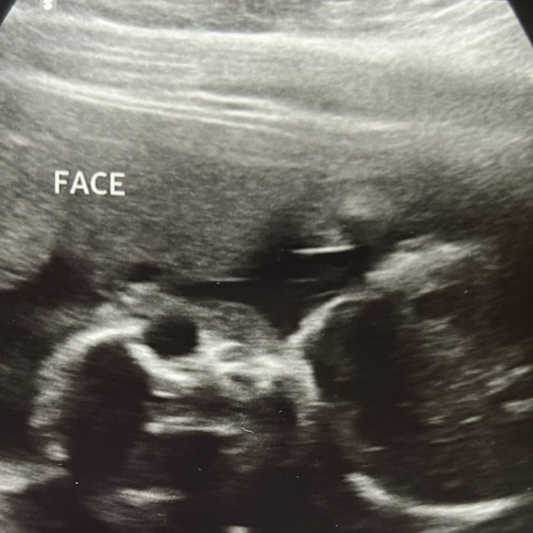 Photo shared by Kaila for their Babylist baby registry.