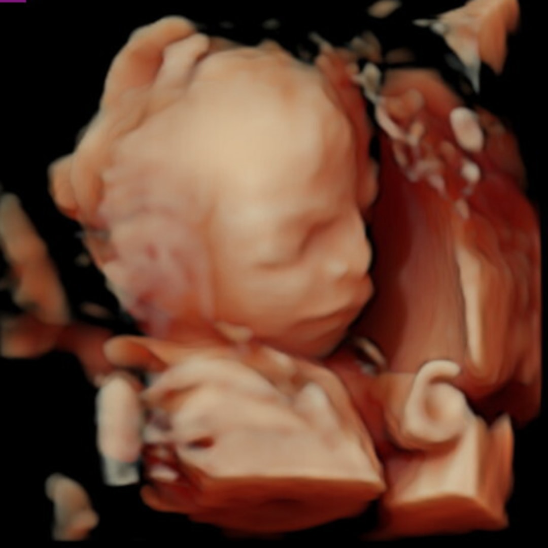 Photo shared by Isabella for their Babylist baby registry.