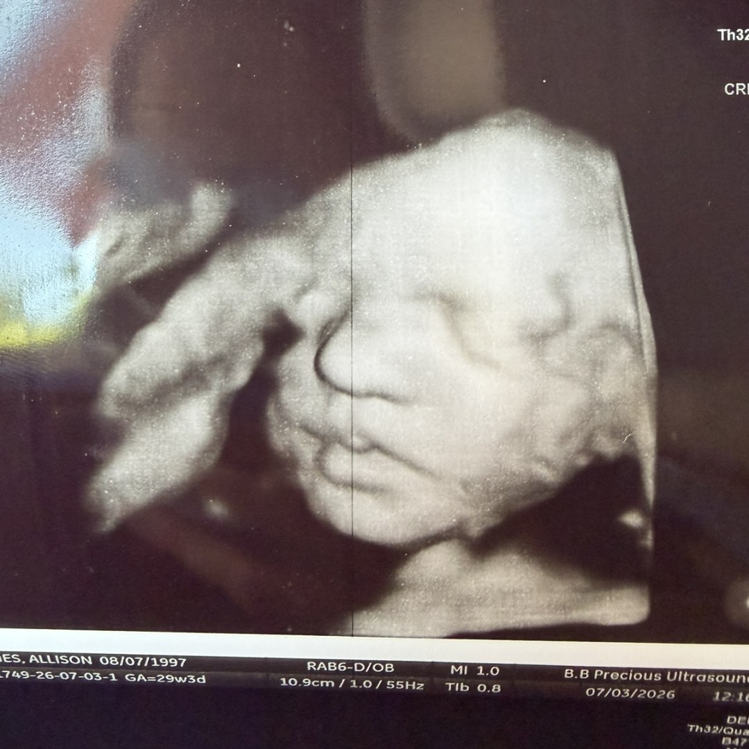 Photo shared by Allison for their Babylist baby registry.