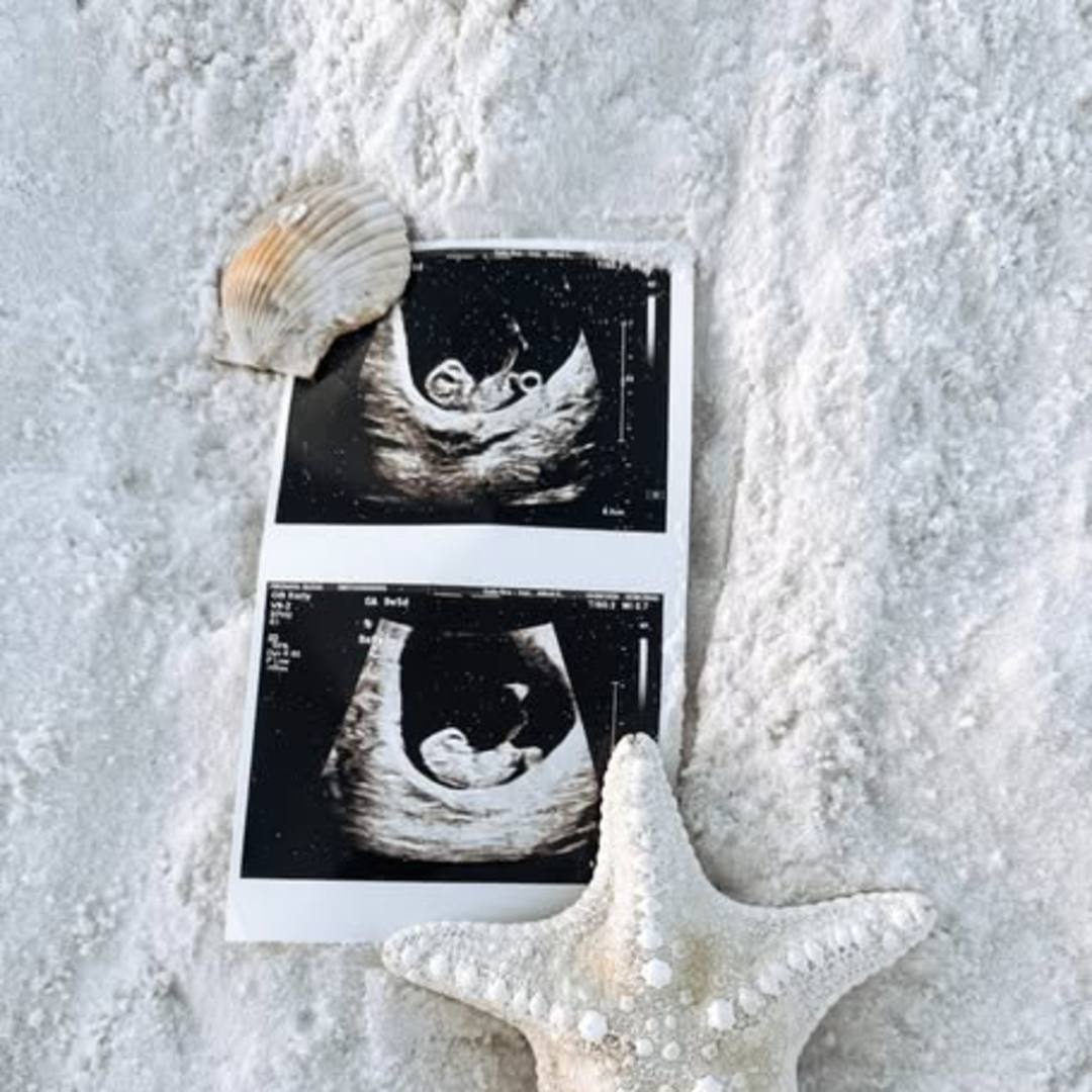 Photo shared by Olivia for their Babylist baby registry.